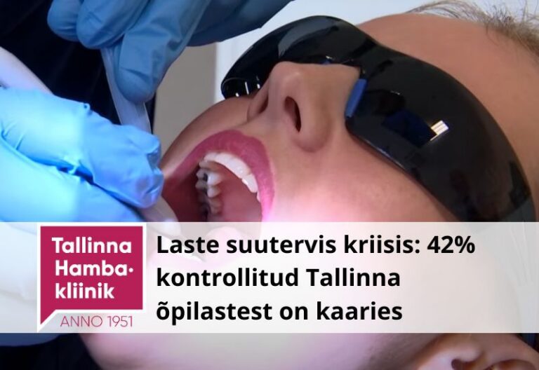 Laste suutervis kriisis: 42% kontrollitud Tallinna õpilastest on kaaries